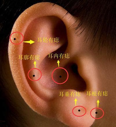 左耳廓有痣|耳朵长痣的位置图解 耳朵长痣的位置图解有福气